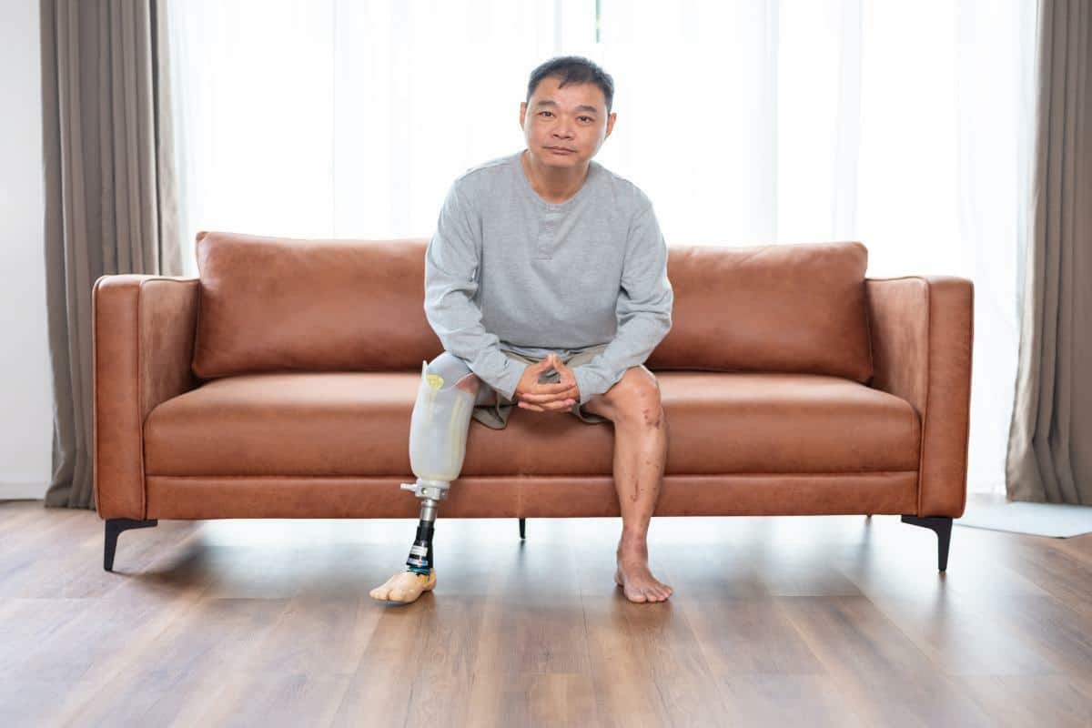 Amputation Injuries: 3 Common Questions from Victims