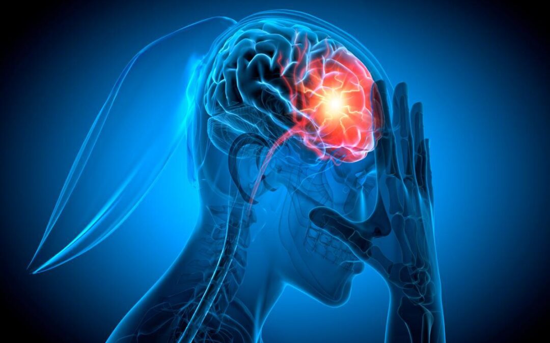 Why a Concussion Can Have Long-Term Consequences